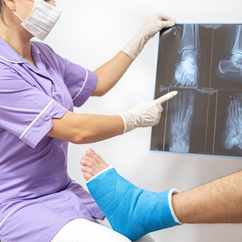Bone fracture foot and leg on male patient being examined by a woman doctor in a hospital.